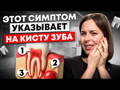 Видео: Обнаружили Кисту? Не Удаляйте Зуб, Пока Не Узнаете ЭТО!