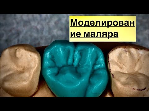 Видео: Моделирование моляра верхней челюсти. Как отмоделировать зуб. Изготовление зубов.