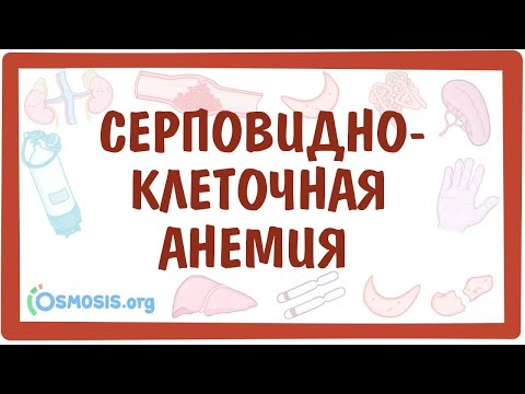 Видео: Серповидно-клеточная анемия  — причины, симптомы, патогенез, диагностика, лечение