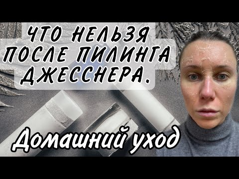 Видео: КАК ВЕСТИ СЕБЯ ПОСЛЕ ПИЛИНГА ДЖЕССНЕРА/ЧТО МОЖНО/ЧТО НЕЛЬЗЯ/ХИМИЧЕСКИЙ ПИЛИНГ