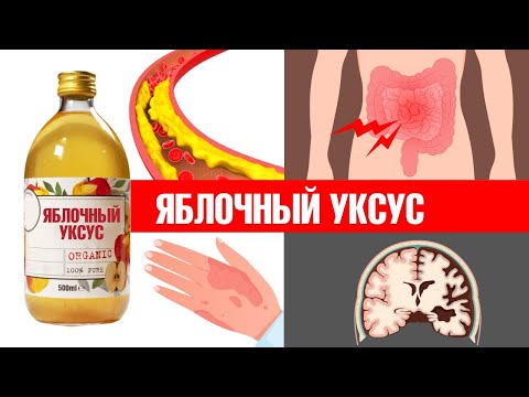 Видео: Польза яблочного уксуса: новые данные💥