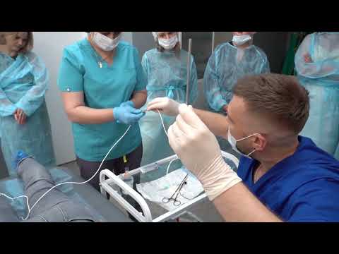 Видео: Импульсная радиочастотная абляция затылочного нерва. Клиника Константа LIFE