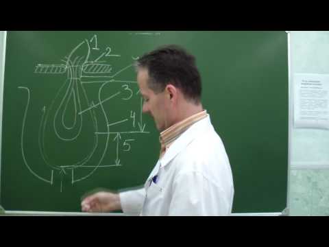 Видео: Элементы грыжи. Этапы грыжесечения