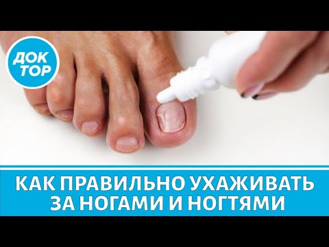 Видео: Как правильно подобрать лечение, чтобы навсегда избавиться от грибка