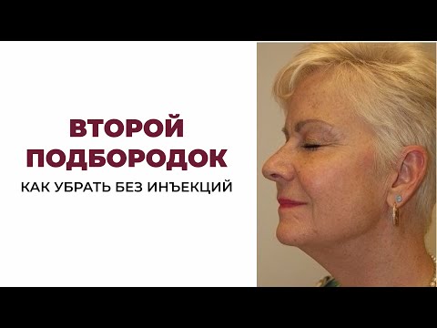 Видео: Как убрать второй подбородок