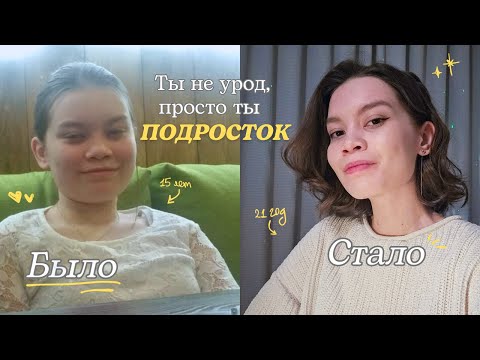 Видео: Естественный glow up | Если ты подросток, посмотри это видео