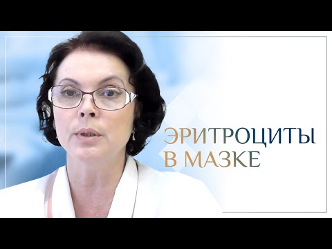 Видео: Эритроциты в мазке