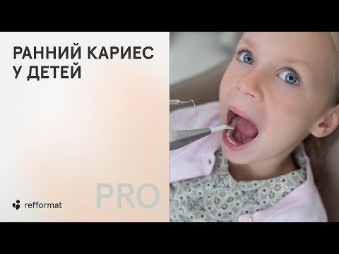 Видео: ​🦷​ Ранний кариес у детей