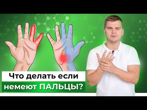 Видео: НЕМЕЮТ руки: что делать? Что делать когда немеют руки? Онемение пальцев рук