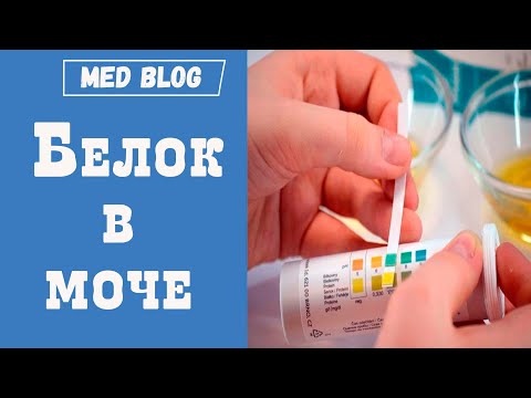 Видео: Белок в моче | Причины высокого белка в моче | Почему повышается белок в анализе мочи