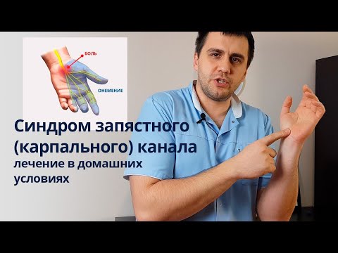 Видео: Синдром запястного (карпального) канала лечение в домашних условиях