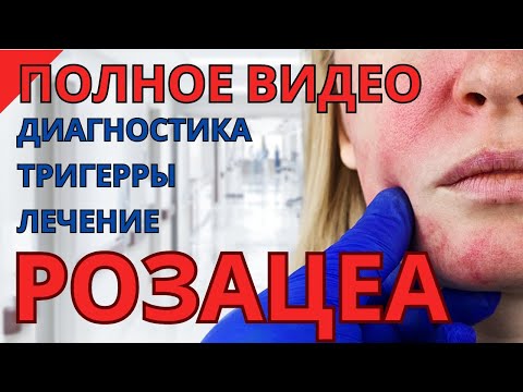 Видео: Что такое розацеа и как от неё избавиться