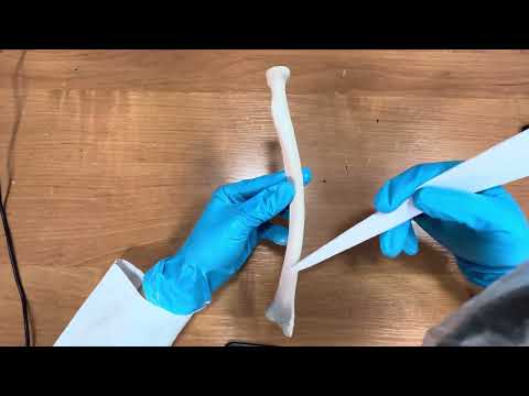 Видео: Кәрі жілік сүйегі құрылысы