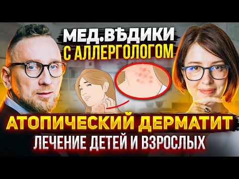 Видео: Атопический дерматит