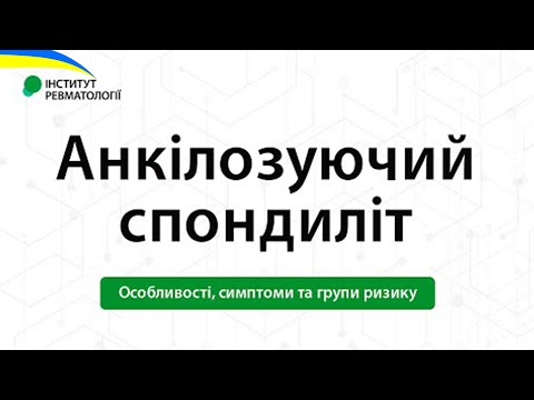 Видео: Анкілозуючий спондиліт. Особливості, симптоми та групи ризику