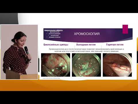 Видео: 4 Николайчук ТВ Сравнительная характеристика эндоскопических методов удаления полипов толстой кишки