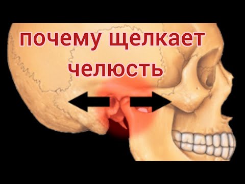 Видео: Что делать если ЧЕЛЮСТЬ щелкает? ЩЕЛЧКИ в челюсти при открывании рта. Почему ЩЕЛКАЕТ челюсть?