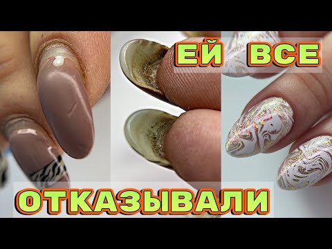 Видео: УЖАСНЫЕ ногти 😦 Клюющие ногти 😦 Сложная коррекция 💅 Красивый дизайн ногтей