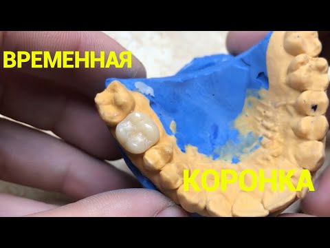 Видео: Как сделать временную коронку. Инструкция.  Видео курс. Зубной техник. Временная коронка