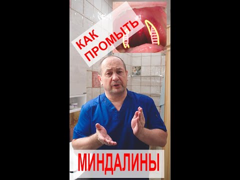 Видео: Как промывать миндалины дома? Просто и понятно. #доктор #миндалины