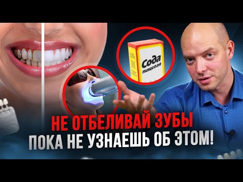 Видео: Отбеливание зубов насколько это вредно? Возможно ли отбелить зубы дома?