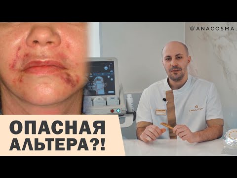 Видео: УЛЬТРАЗВУКОВОЙ СМАС ЛИФТИНГ ⛔  ОСТОРОЖНО ⚠️‼️ ОПАСНАЯ АЛЬТЕРА