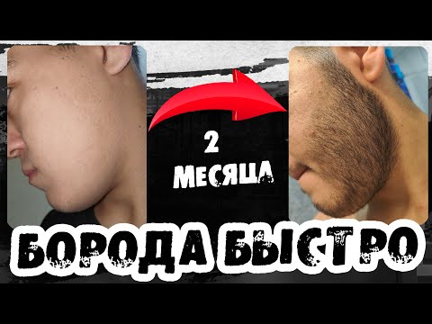 Видео: Капиксил М запустил рост бороды / Результаты / Выпуск 53 / Андрей Борода