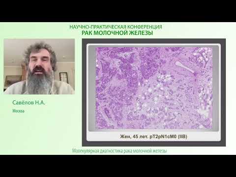 Видео: Внутриопухолевая гетерогенность и клональная эволюция рака молочной железы