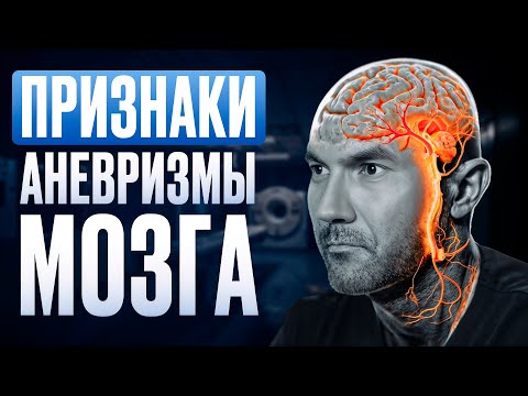 Видео: Аневризма головного мозга — пошаговая диагностика и лечение