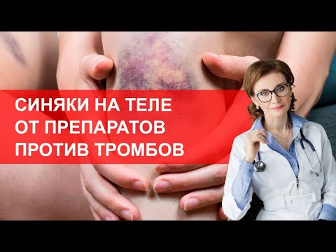 Видео: Синяки на теле от лекарств против тромбов