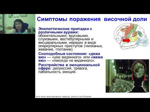 Видео: Усова Н.Н. Симптомы поражения височной доли
