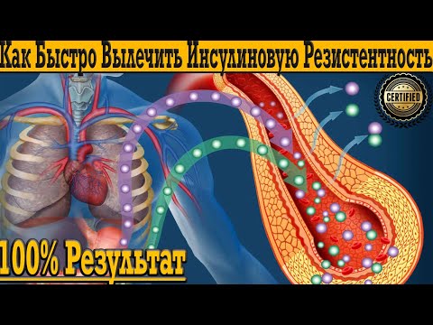 Видео: Как Быстро Вылечить Инсулиновую Резистентность и Метаболический Синдром!