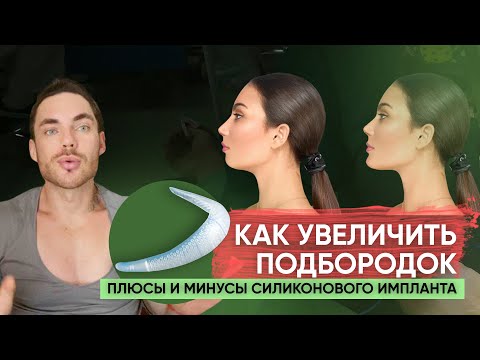Видео: ПОДБОРОДОК . КАК УВЕЛИЧИТЬ ПОДБОРОДОК Силиконовый имплант или Филлер ,ПЛЮСЫ И МИНУСЫ