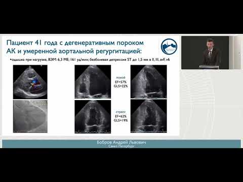 Видео: Роль стресс-эхо в определении тяжести клапанной недостаточности и показаний к оперативному лечению