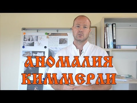 Видео: Аномалия Киммерли или задний мостик атланта - виды аномалии, диагностика, решение