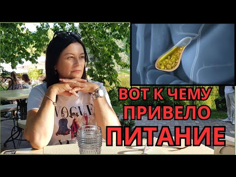 Видео: Вы будете в ШОКЕ! Жёлчный под угрозой Удалять или лечить?Мой путь через БЕЗОБРАЗНОЕ питание и ошибки