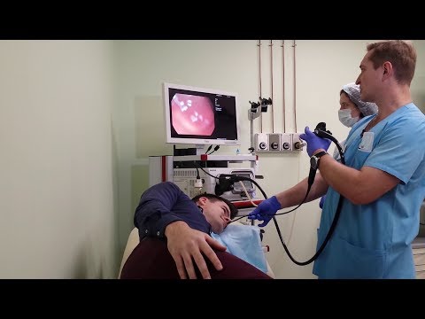Видео: Лёгкая гастроскопия в «Гранд Медике»