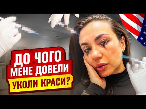 Видео: Не роби цього! ОЗЕМПІК та БОТОКС — вся ПРАВДА про б'юті-індустрію в Америці!