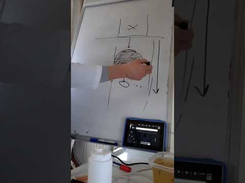 Видео: Простые принципы УЗИ. отражение, преломление. Эхогенность тканей