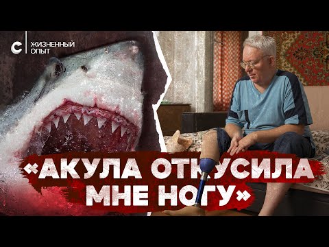 Видео: «Вместо ноги только кость торчит». Пережил нападение акулы