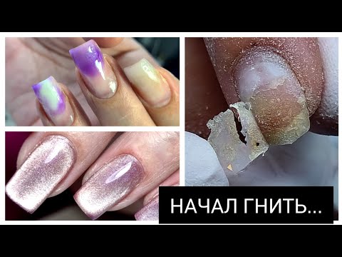 Видео: БЕДА с ногтем @bornprettyofficial