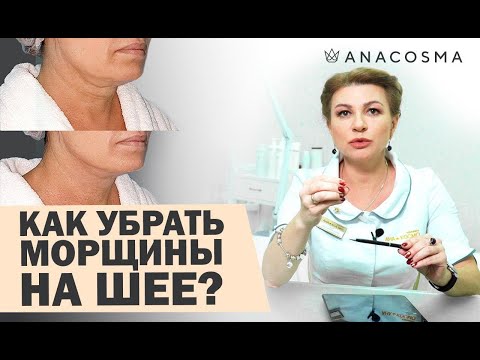 Видео: 🔥Убрать морщины на шее 🔥 Кольца Венеры на шее🔥Тяжи на шее! - Хусид Ольга Владимировна