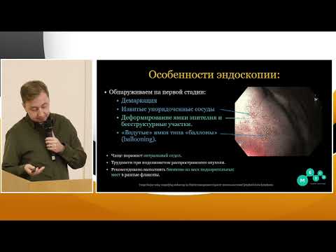 Видео: 1 Архипов В.В. Валиулин Э.Р. Иванов И.И., Николайчук Т.В. MALT-лимфома желудка: не дай себя обмануть