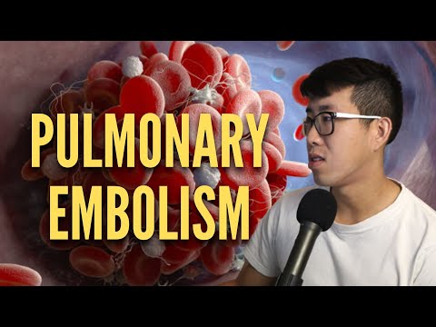 Видео: ТГВ/ПЭ — чему я учу