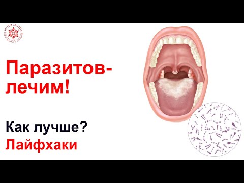 Видео: Паразитов- лечим!Как лучше? Лайфхаки