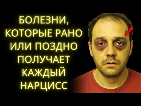 Видео: Тело Нарцисса Умирает Медленно — И Он Даже Не Замечает Этого