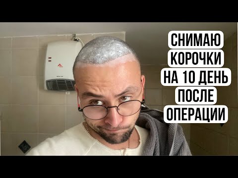 Видео: СНЯТИЕ КОРОЧКИ НА 10 ДЕНЬ ПОСЛЕ ПЕРЕСАДКИ ВОЛОС