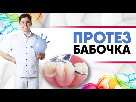 Видео: Протез бабочка [ птичка, флиппер ] - съёмный микропротез для восстановления одного или 2/3 зубов.