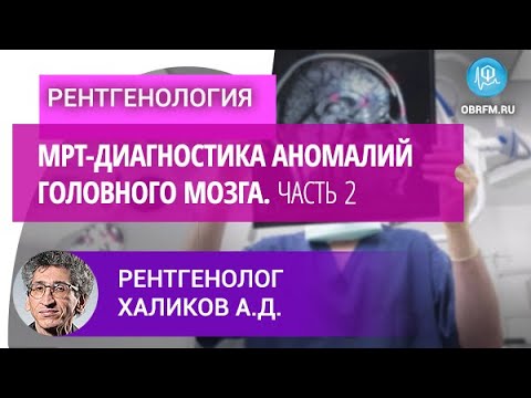 Видео: Рентгенолог Халиков А.Д.: МРТ-диагностика аномалий головного мозга. Часть 2