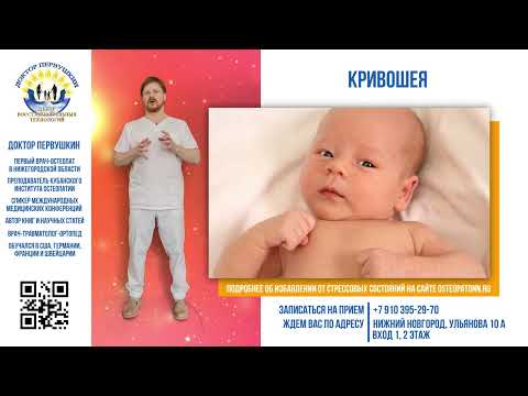 Видео: Остеопатическое лечение кривошеи